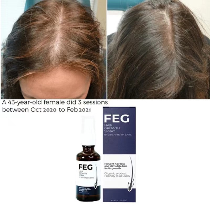 FEG Plus Hair Growth Oil 50ml – Promote Healthy Hair